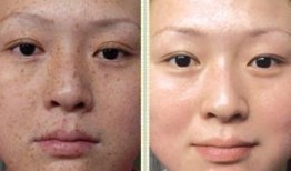 解斑爆料最新,揭秘娱乐圈最新热点事件内幕